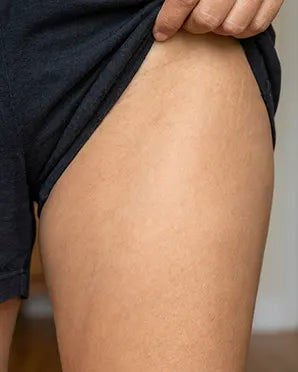 Inner thighs