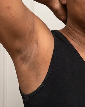 Underarms